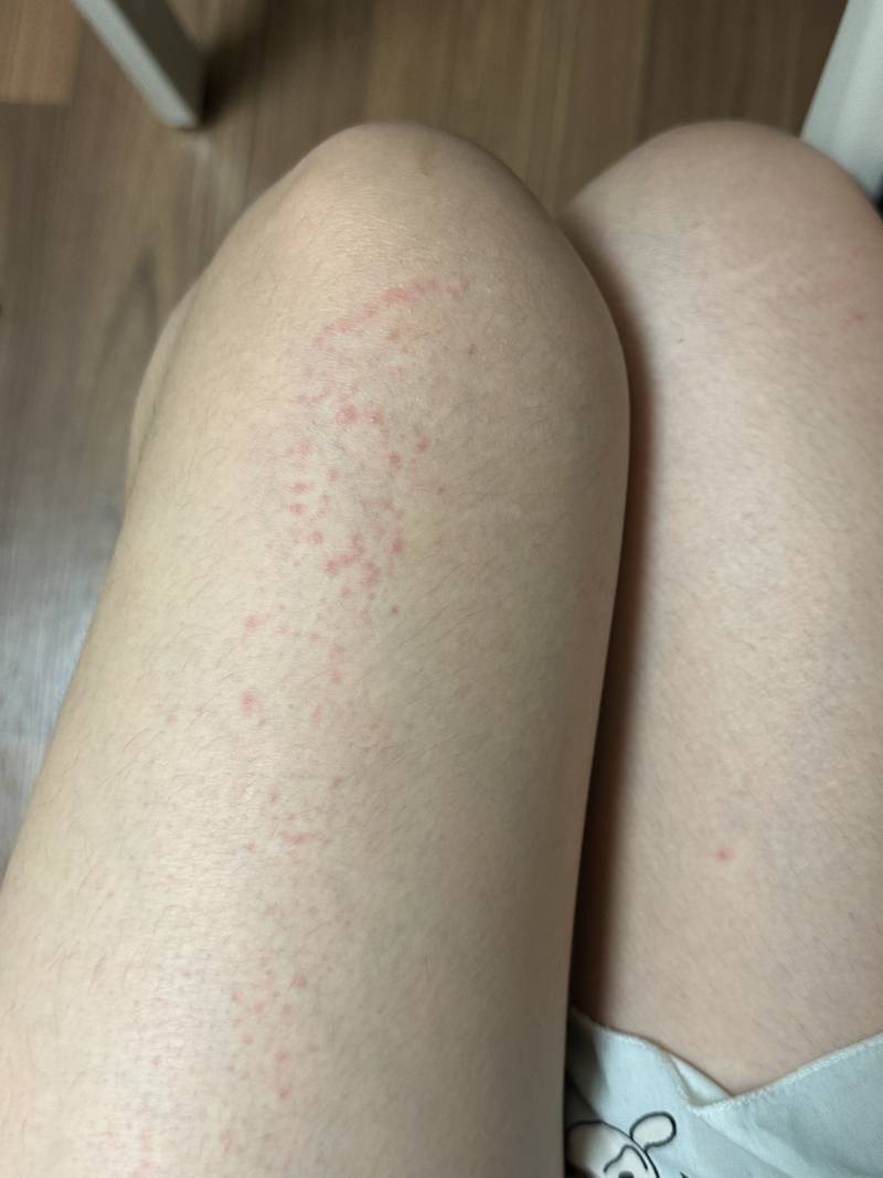 [잡담] 와 아침에 면도기로 제모했는데 (ㅎㅇㅈㅇ) | 인스티즈