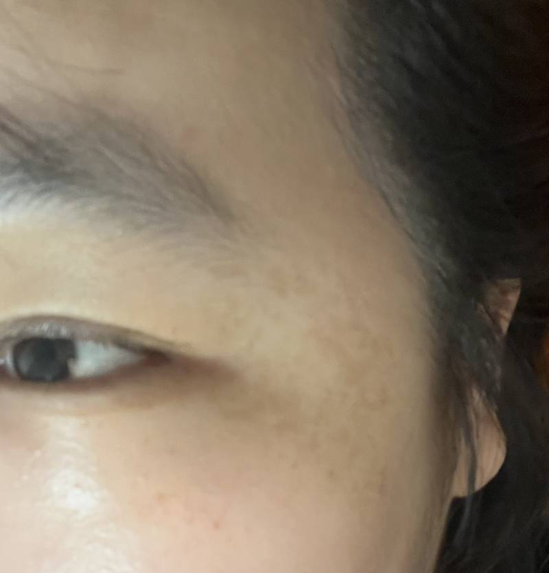 [잡담] 기미 많이 심해보여? | 인스티즈