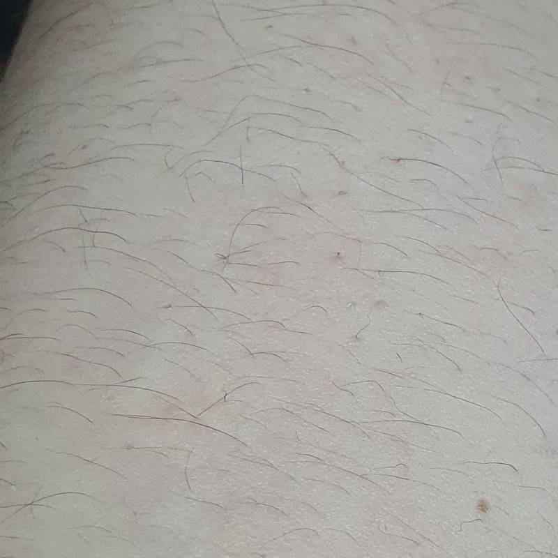 [잡담] 다리털 개많은데 수영배운다고 제모하는거 오바야?(ㅎㅇㅈㅇ) | 인스티즈