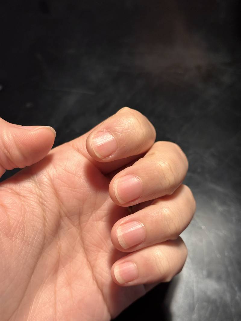[잡담] 손톱 물어뜯다가 이만큼 길렀는데 여기서 시럽네일 한 번 할가 아님 더 참고 할까 .. | 인스티즈