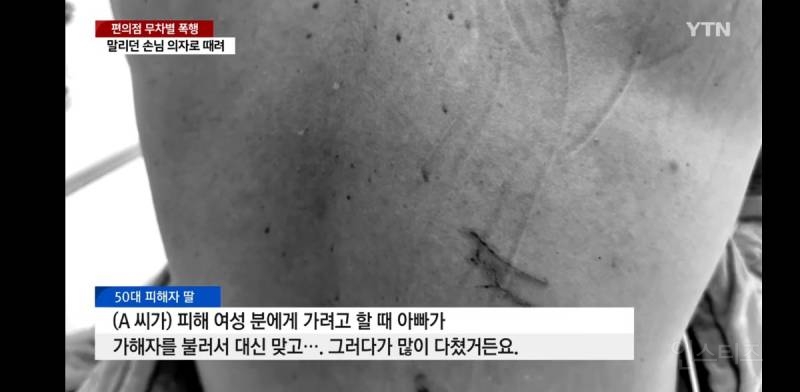 (폭행주의) 머리 짧으니 페미라며 알바생 폭행한 20, 딸 같은데 보고만 있냐며 말리다 중상 입은 50대 어르신 | 인스티즈