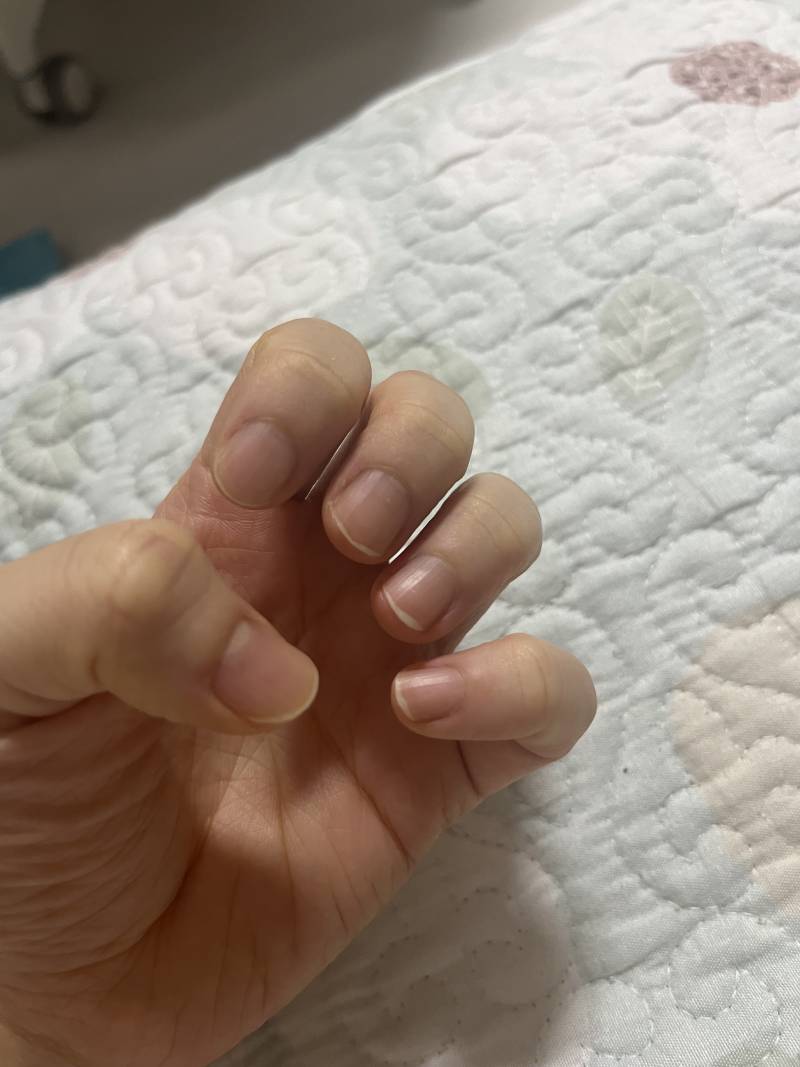 [잡담] 얘들아 나 이정도 손톱이면 네일 받을 수 있어?? | 인스티즈