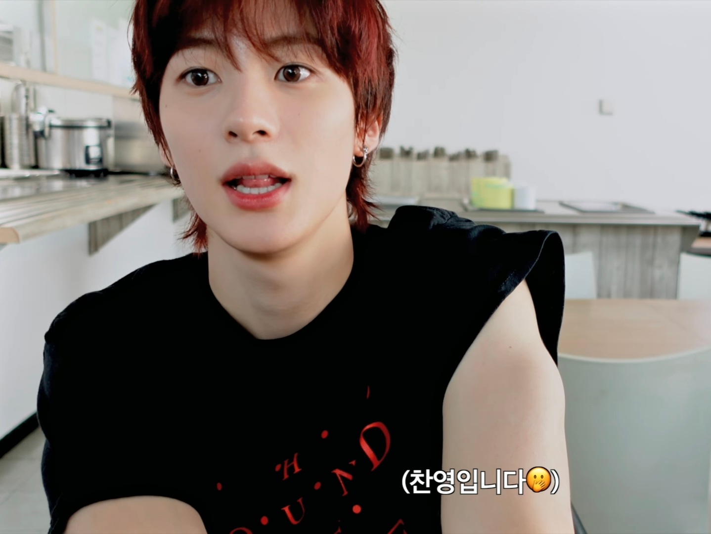 [잡담] 아니얘들아 앤톤 얼굴 무슨일이야 | 인스티즈