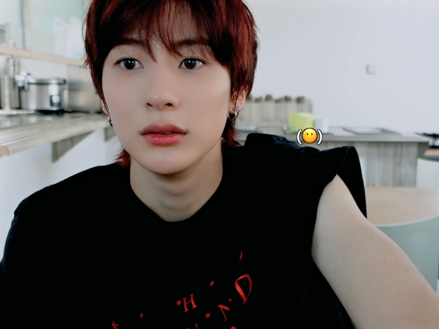 [잡담] 아니얘들아 앤톤 얼굴 무슨일이야 | 인스티즈