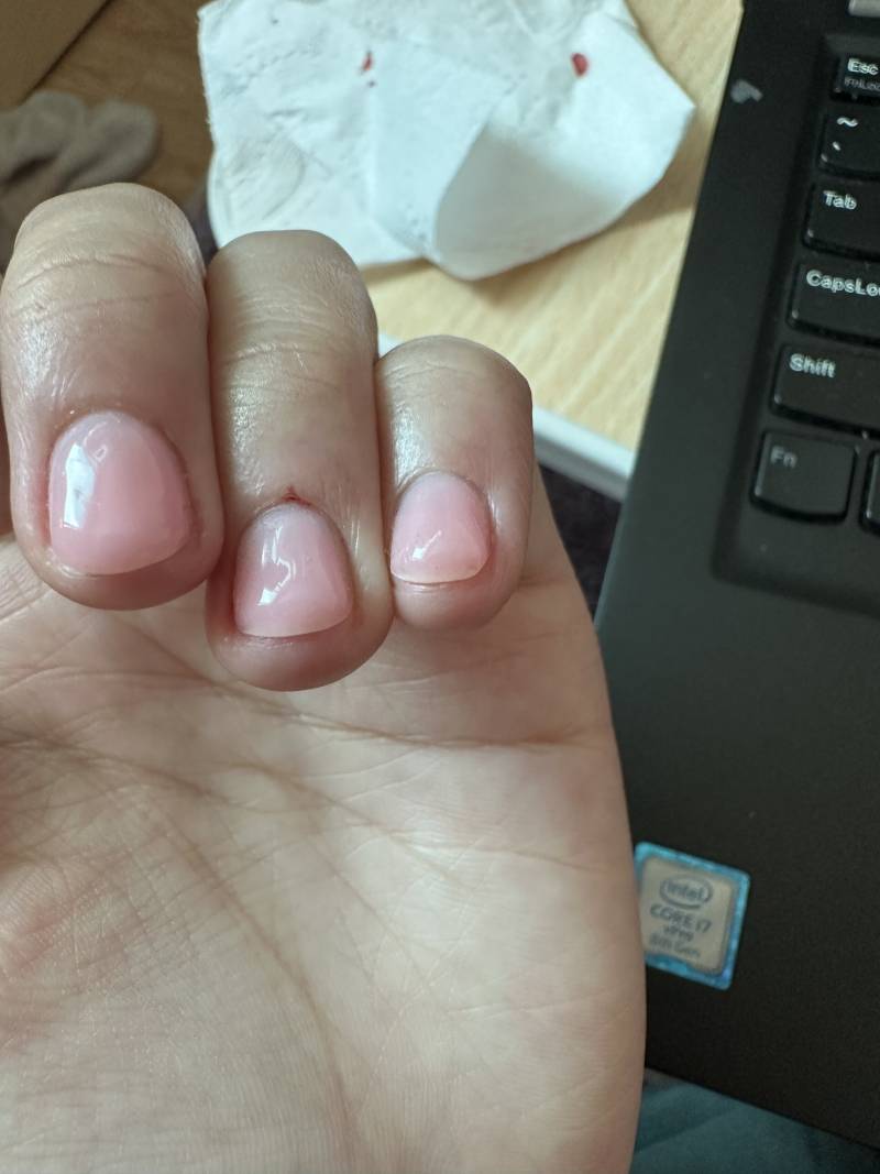 [잡담] [유혈사진주의] 인생 첫 젤네일 했는데 원래 이거 맞아? | 인스티즈