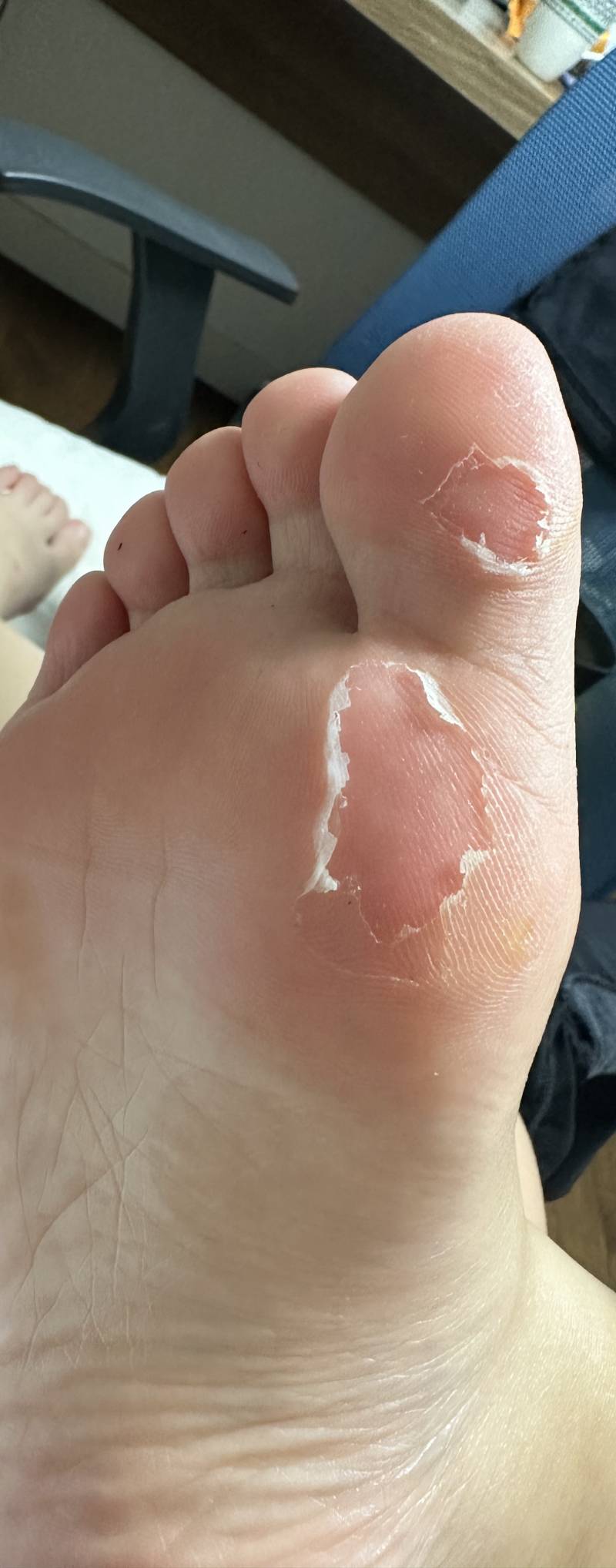 [잡담] 나 발 이거 왜 이런걸까? | 인스티즈