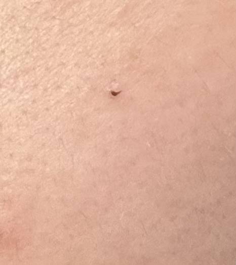 [잡담] 이거 피부과 가야 하나?? | 인스티즈