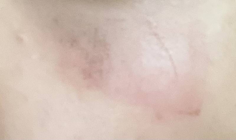 [잡담] 애들아 ㅠㅠㅠ이거 뭐야? 왜그래? / 피부 ㅠㅠㅠ | 인스티즈