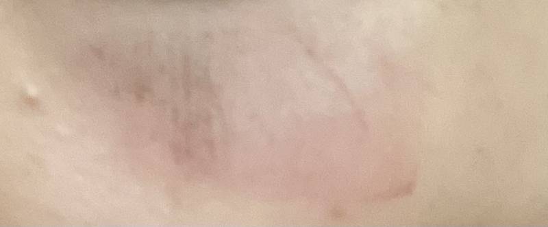 [잡담] 애들아 ㅠㅠㅠ이거 뭐야? 왜그래? / 피부 ㅠㅠㅠ | 인스티즈