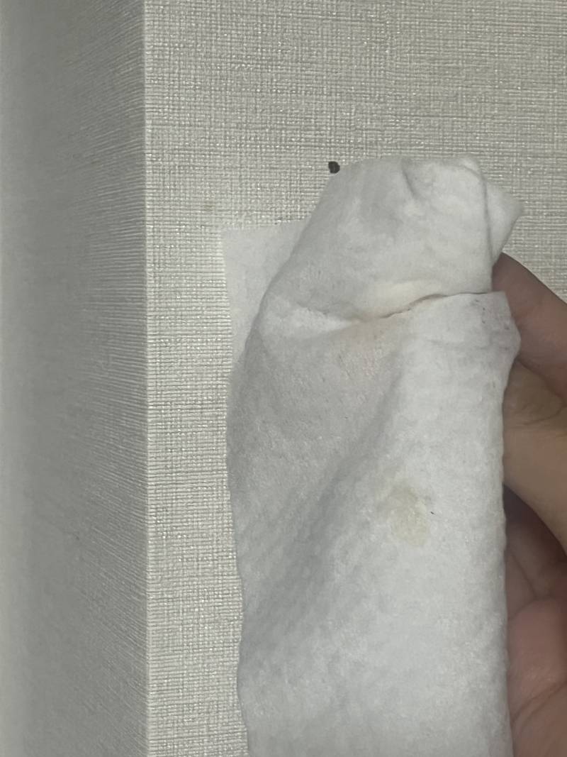 [잡담] 혹시 이거.빈대 흔적일까??? | 인스티즈