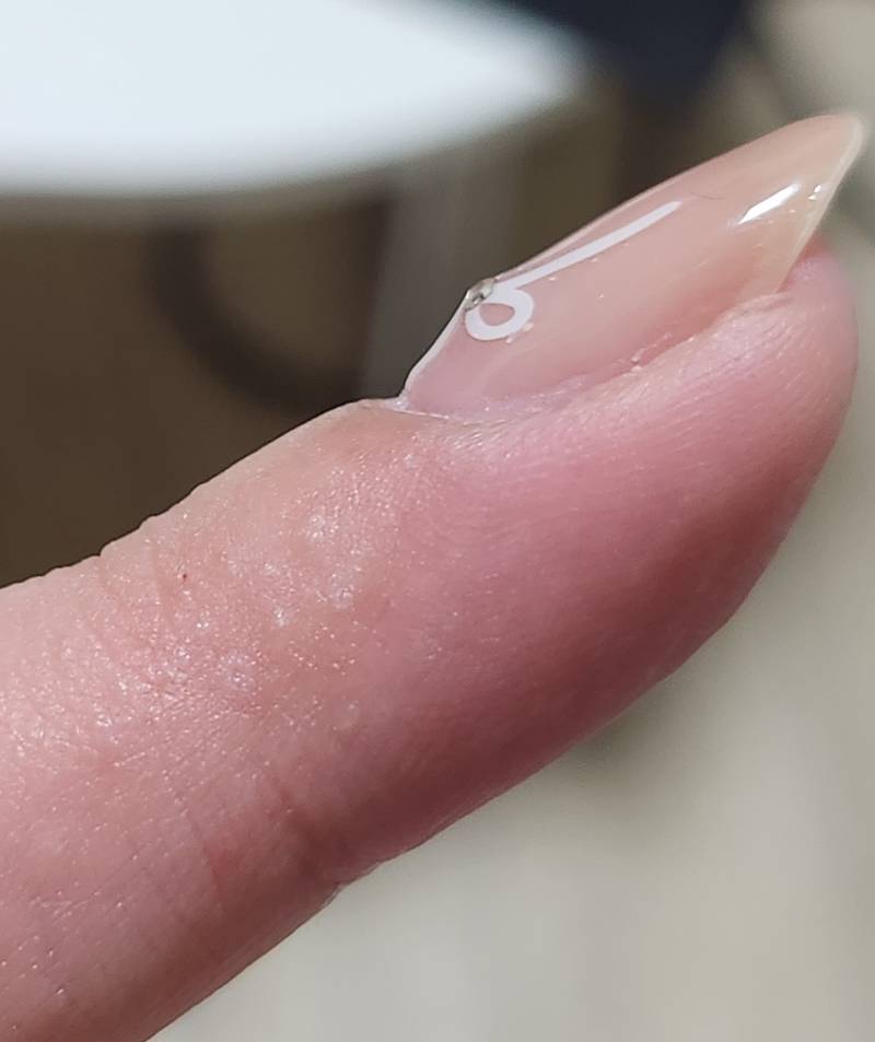 [잡담] 혐오주의 자고 일어났는데 손라락이 이렇게 됐어....... | 인스티즈