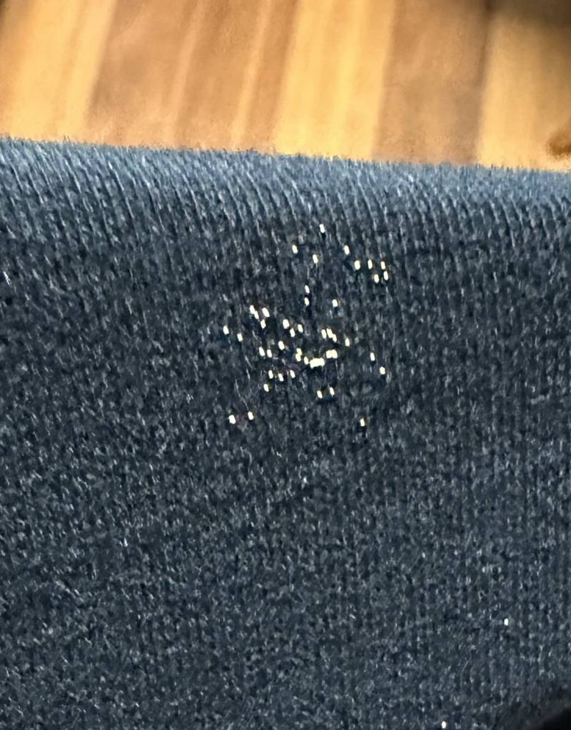 [잡담] (혐오주의)걸어두기만 한 옷에 이런 게 생겨있는데 뭔지 아는 익 ㅜㅠㅠㅠㅜㅜ | 인스티즈