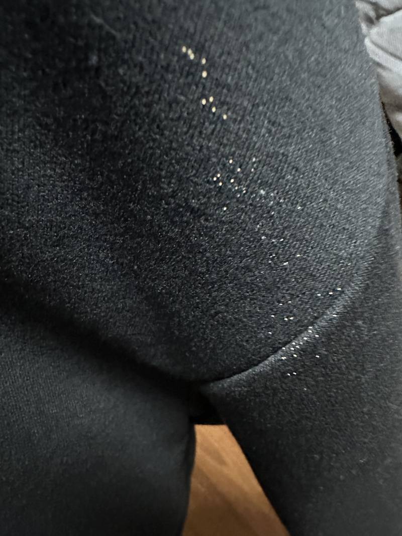 [잡담] (혐오주의)걸어두기만 한 옷에 이런 게 생겨있는데 뭔지 아는 익 ㅜㅠㅠㅠㅜㅜ | 인스티즈