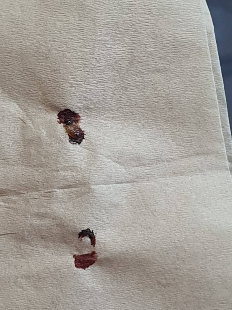 [잡담] 이거 설마 빈대야..?(혐오주의) | 인스티즈