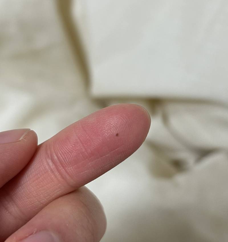 [잡담] 이거 빈대 아니지?.. | 인스티즈