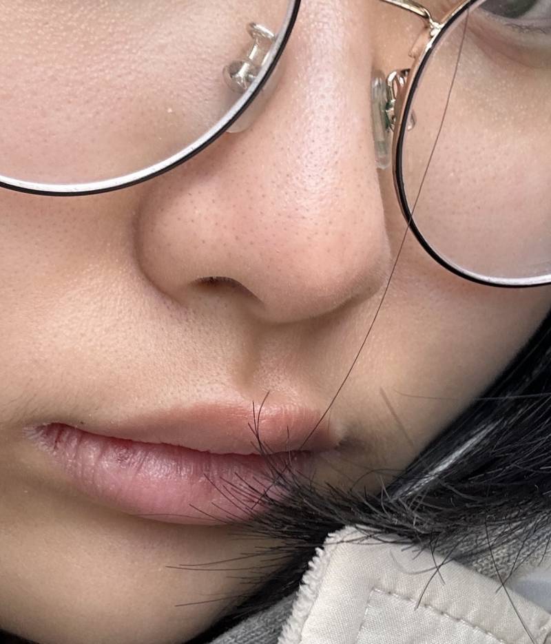 [잡담] 나 모공 많이 심해??? | 인스티즈