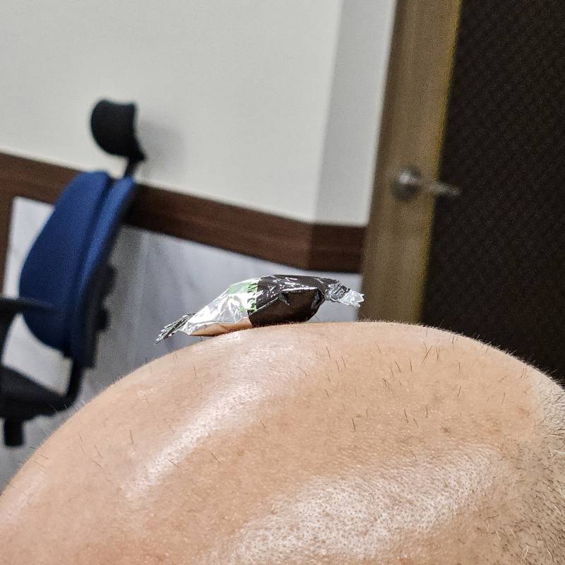 [잡담] 오늘 환자가 사탕 하나 달랬는데 하나 탁 머리에 붙여줬거든 | 인스티즈