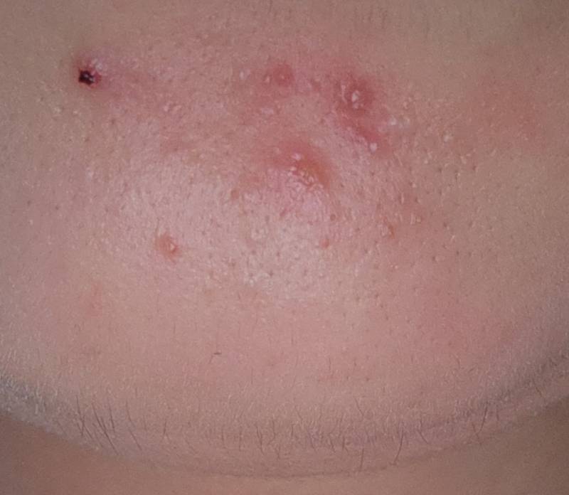 [잡담] 이거 다낭성이야???사진 ㅎㅇㅈㅇ | 인스티즈