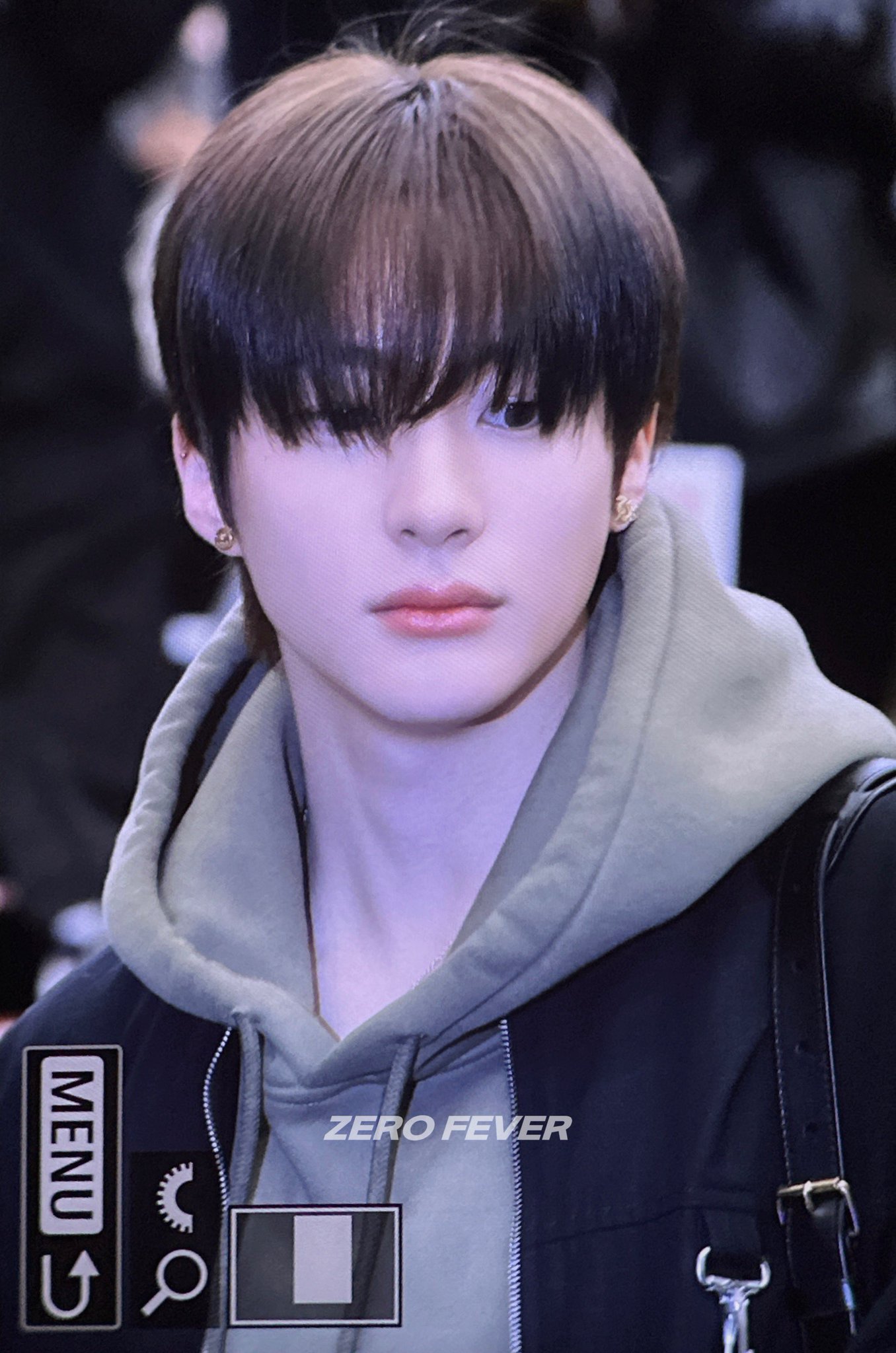 [잡담] 아니 앤톤 사실상 눈은 제대로 보이지도 않는데 | 인스티즈