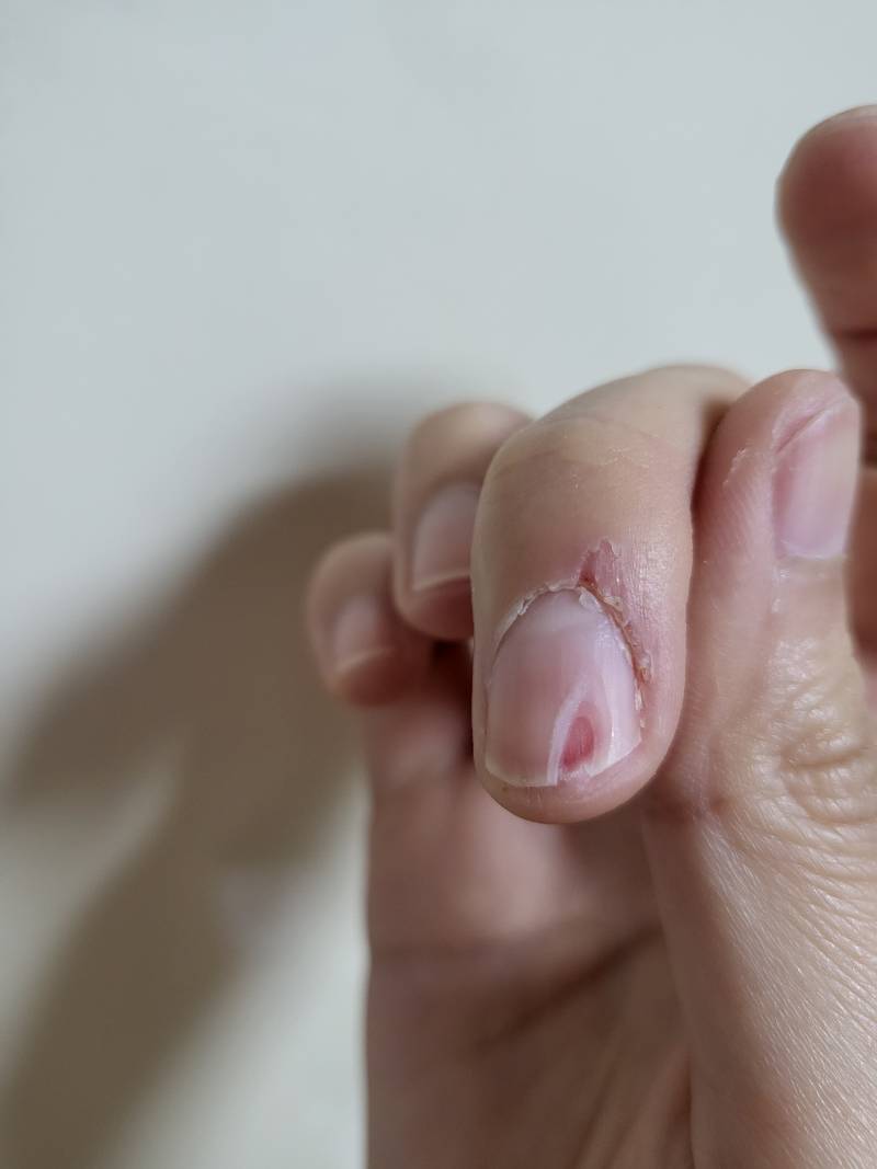 [잡담] (혐오주의) 이거 병원 가야할까...? | 인스티즈