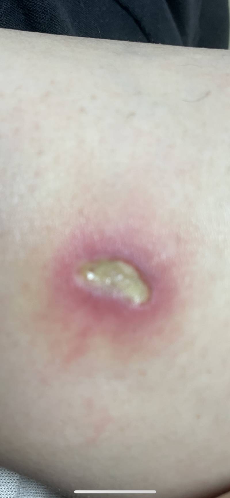 [잡담] 혐오주의 이거 병원가야겠지? | 인스티즈