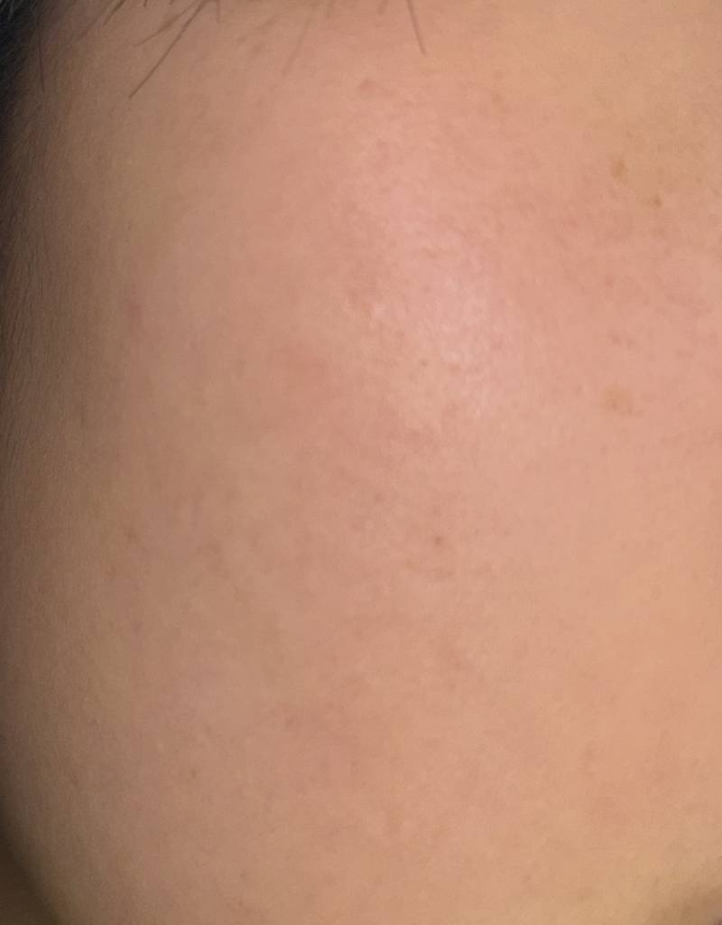 [잡담] 어때 애들아 나 피부 좋지 | 인스티즈