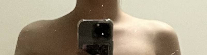 [잡담] 이 정도면 승모근 있는 편이야?? | 인스티즈