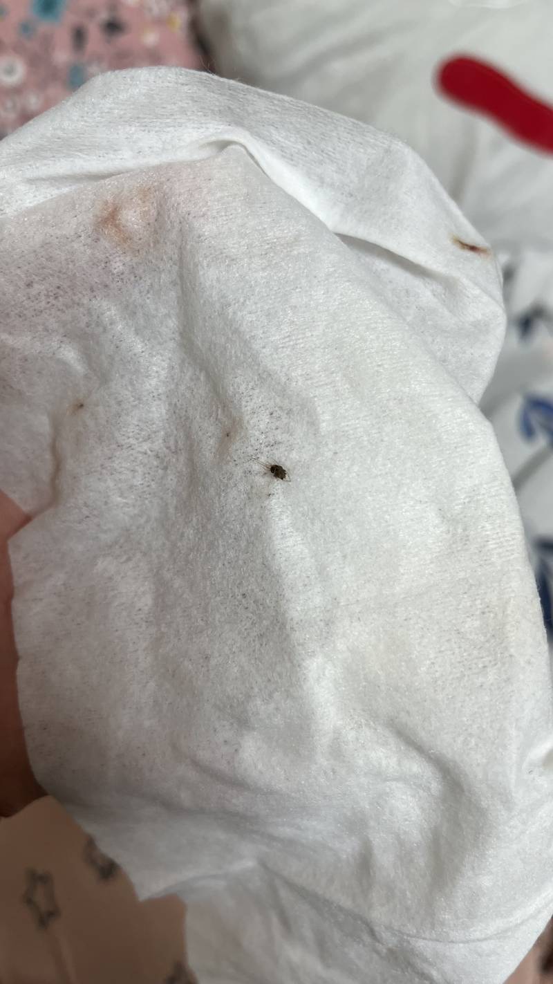 [잡담] 이거 빈대는 아니겠지 ..?? ㅜㅜ 무슨 벌레일까 ㅠㅠ(혐오주의) | 인스티즈