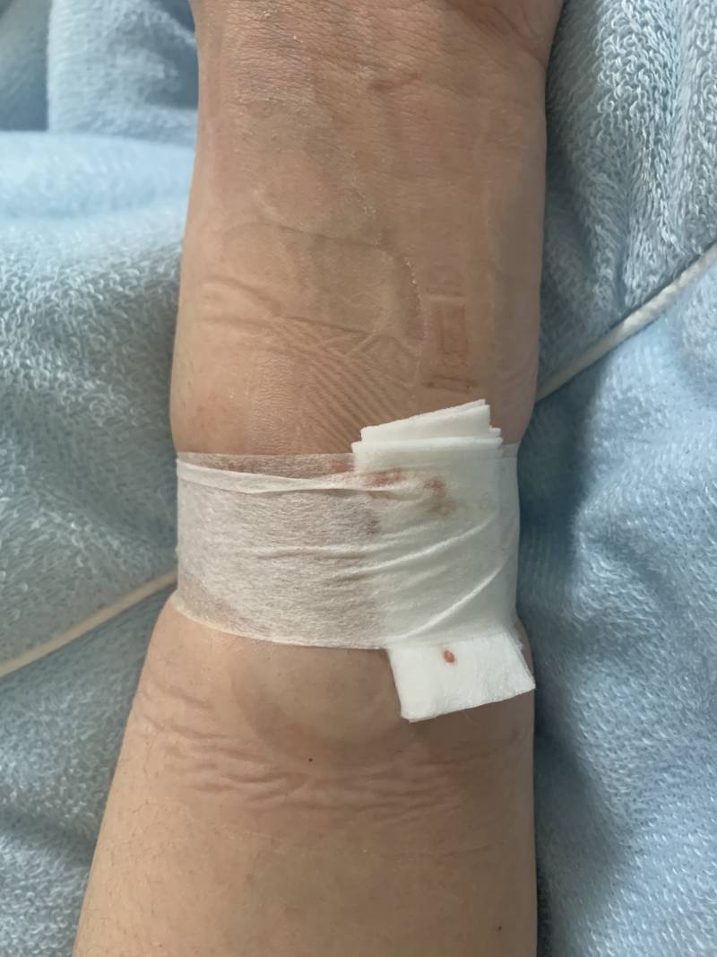 [잡담] 퇴원이다 | 인스티즈