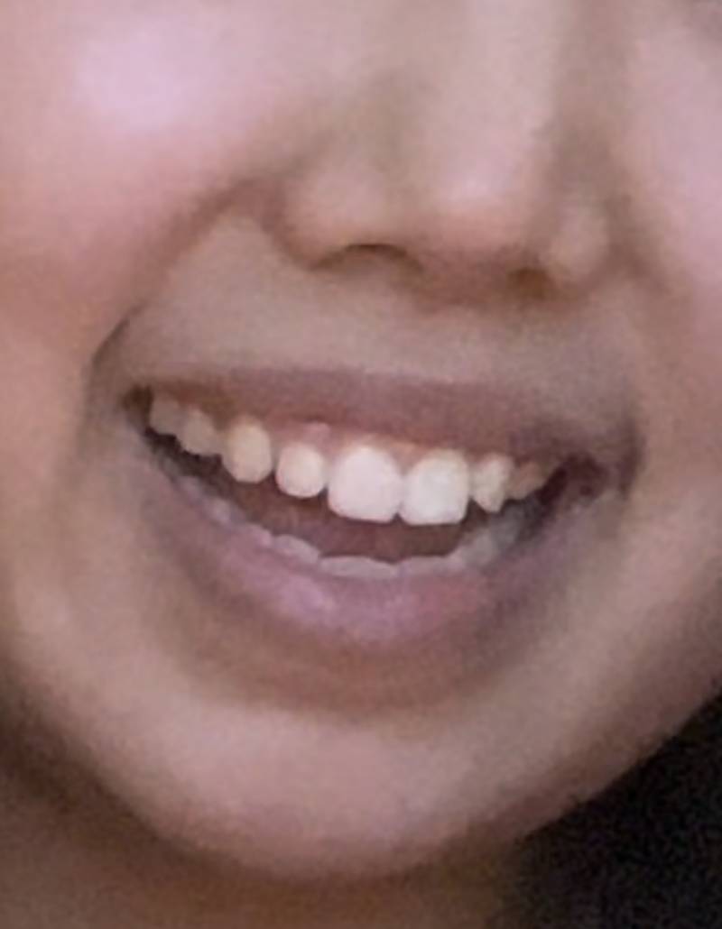 [잡담] 교정해야될까 | 인스티즈