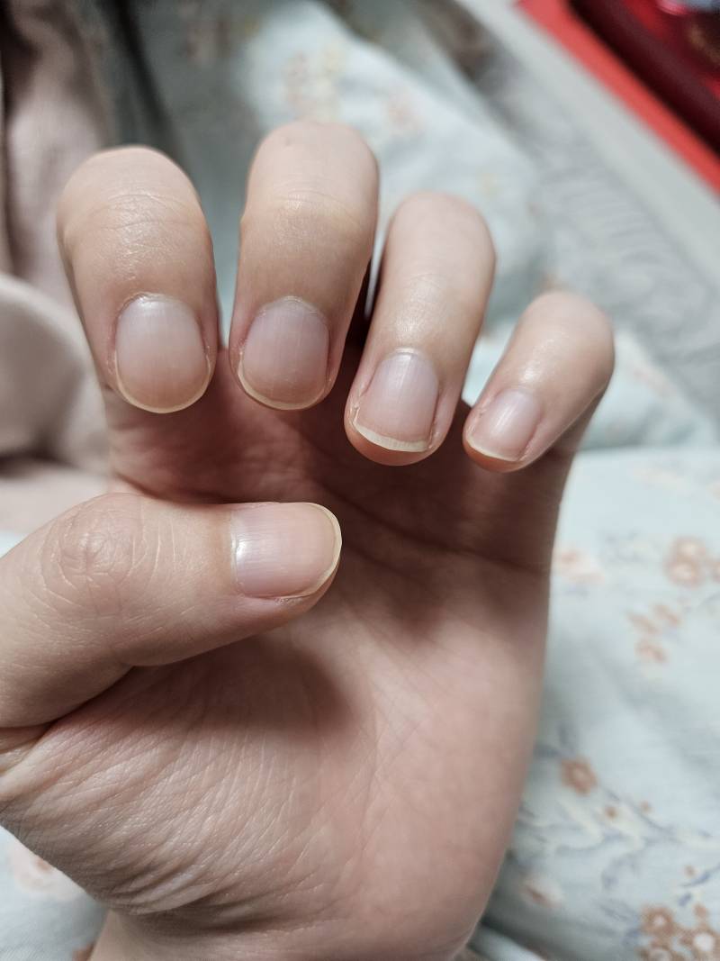 [잡담] 여익들아 나 손톱길이 이런상태에서 네일샵 가는거 비추?? | 인스티즈