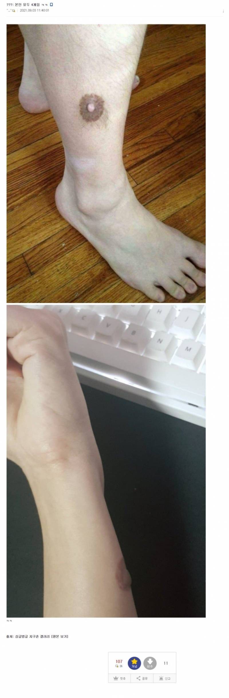 [잡담] 임신 신체변화 글보고 부유두라는걸 검색했는데 ㅎㅇㅈㅇ | 인스티즈