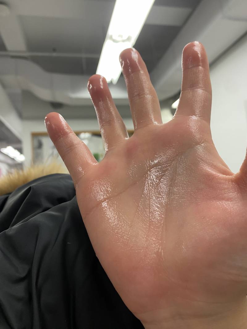 [잡담] 내 다한증 보고가 | 인스티즈