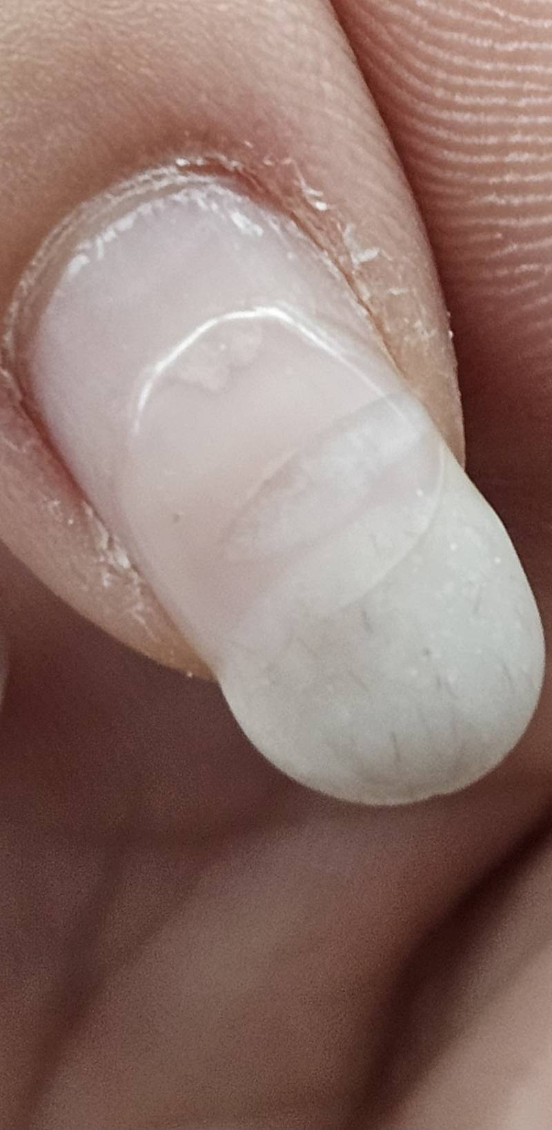 [잡담] 이거 손톱 부러진거 같아?? | 인스티즈