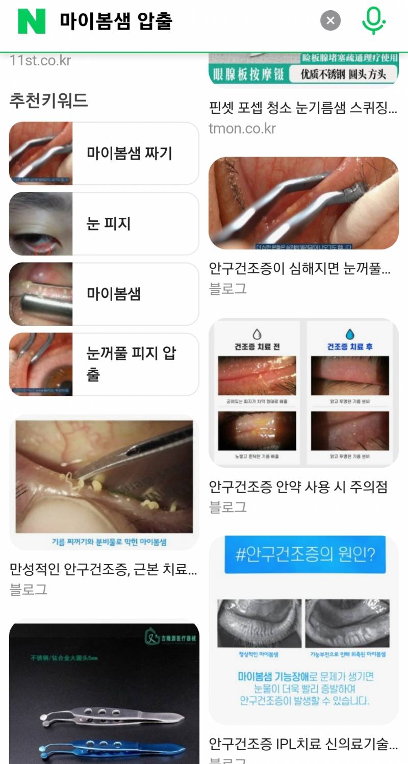 [잡담] ㅎㅇㅈㅇ) 마이봄샘 압출 해본 익 있어?? | 인스티즈