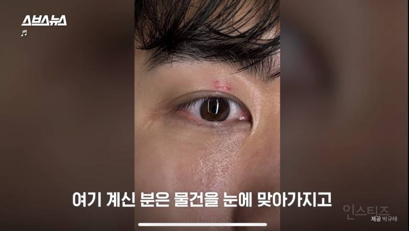 사우디 관중들이 물건 던져서 눈가가 찢어진 한국인 | 인스티즈