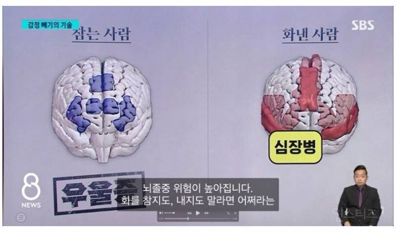 화 참는 사람 뇌 vs 화낸 사람 뇌 | 인스티즈