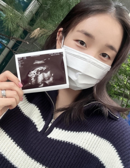 [정보/소식] 백아연, 엄마된다…"임신 5개월, 성별은 딸" | 인스티즈