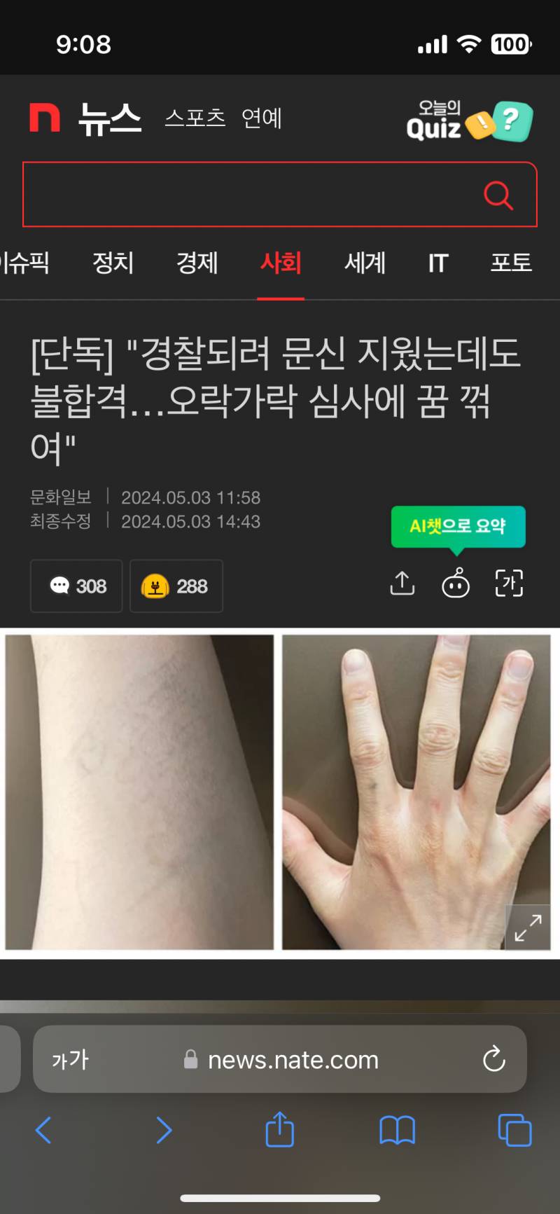 [잡담] 문신할려는 애들 이 기사 보고 한번만 거 생각해봐 | 인스티즈