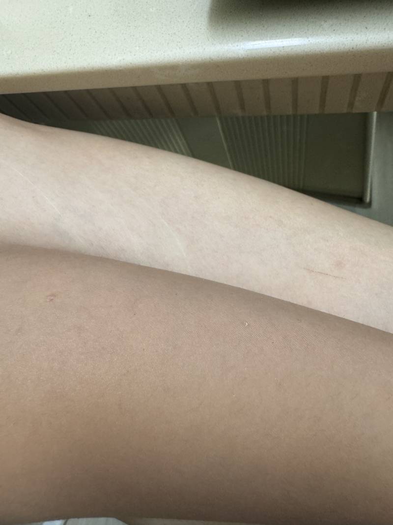 [잡담] 나 팔 개타서 다리색깔이랑 차이 심한데 | 인스티즈