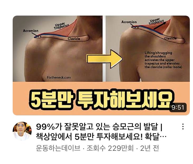 [잡담] 나 어깨 여기 오른쪽이랑 똑같은데 맘에안들어... | 인스티즈