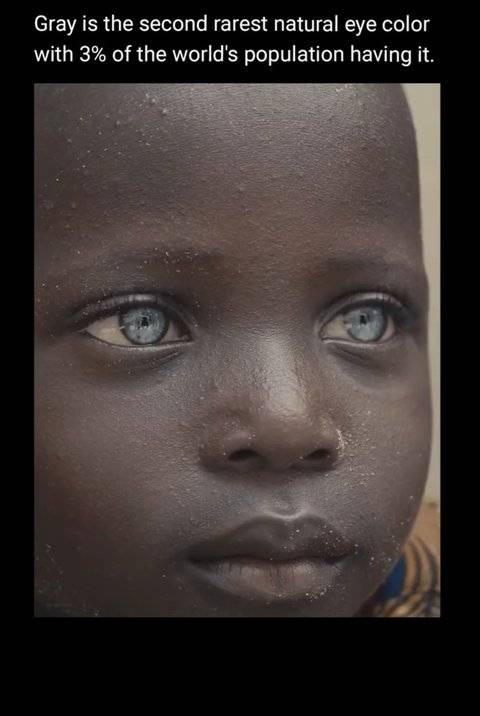 [잡담] 아프리카에도 파란눈을 가진 사람이 존재하는구나 | 인스티즈