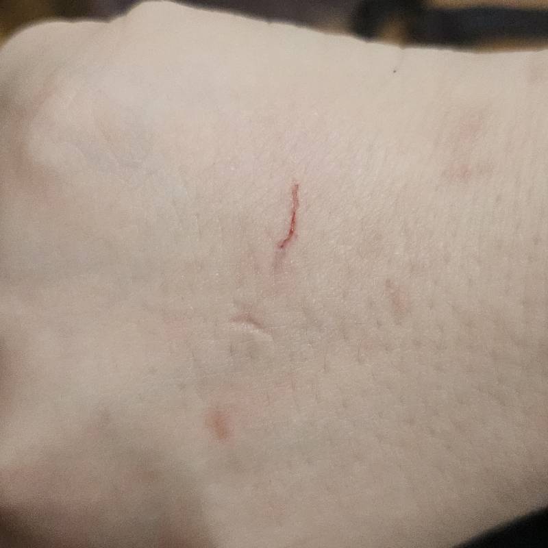 [잡담] 고양이 손발톱 자르다가 내 손만 상처 생김ㅠㅠ | 인스티즈