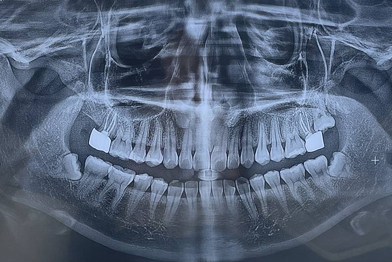[잡담] 이 경우에 치과에서 일부라도 환불 가능할까?ㅠㅠ | 인스티즈