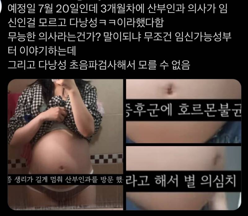 [잡담] 유튜브 36주 낙태 영상 주작썰 이거 봄? | 인스티즈