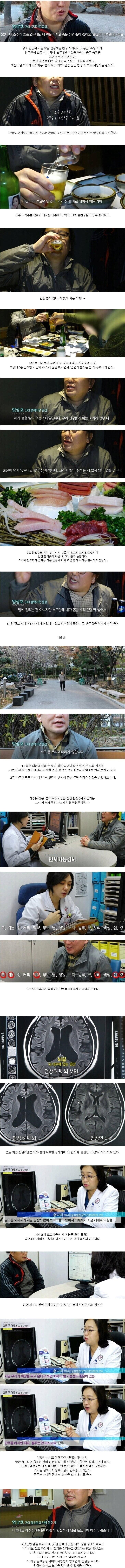 50대 애주가의 뇌상태.jpg | 인스티즈