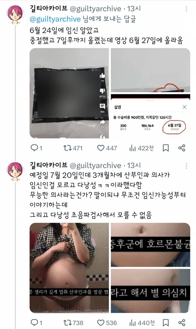 36주 낙태 브이로그 주작의심 증거.twt | 인스티즈