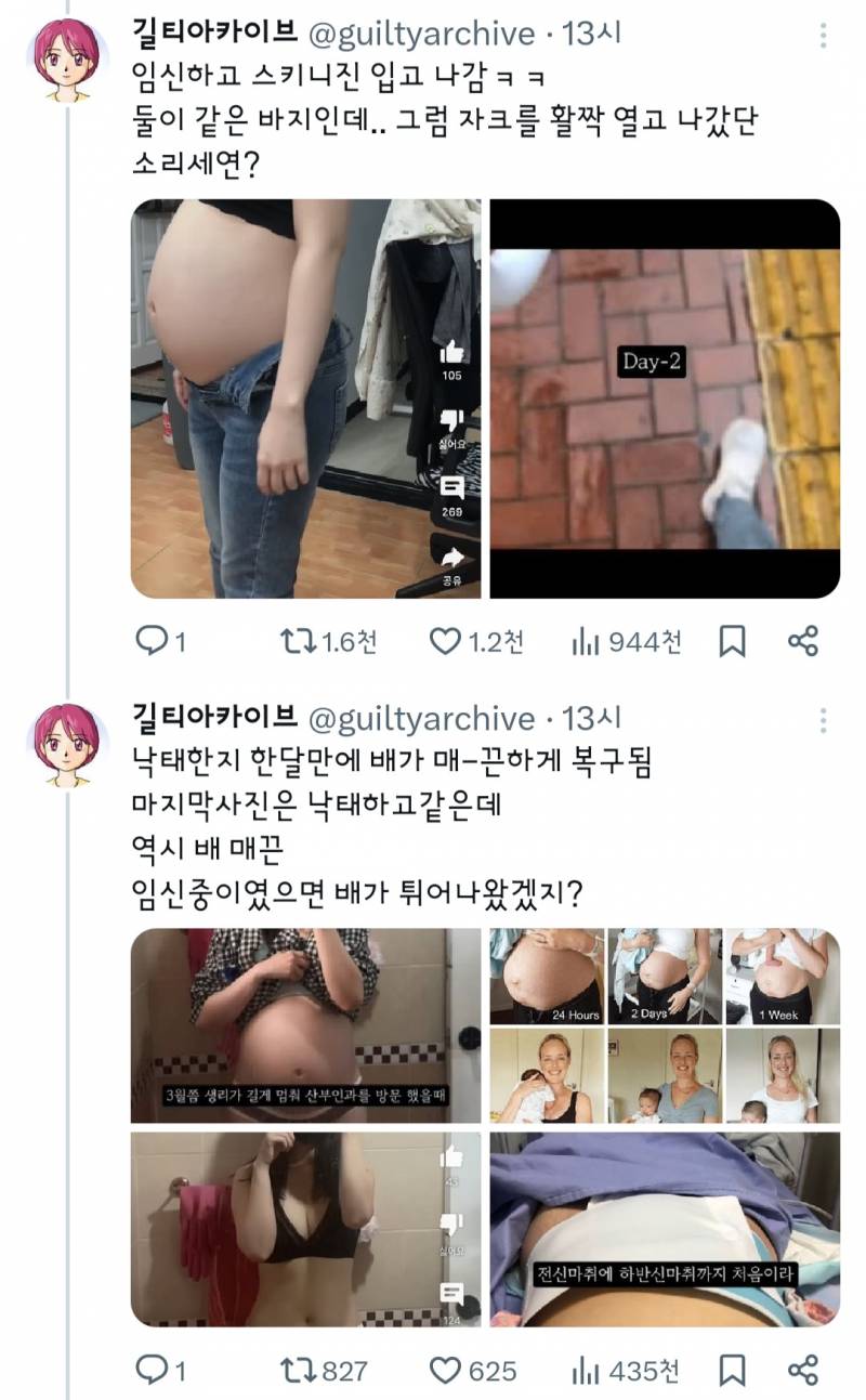 36주 낙태 브이로그 주작의심 증거.twt | 인스티즈