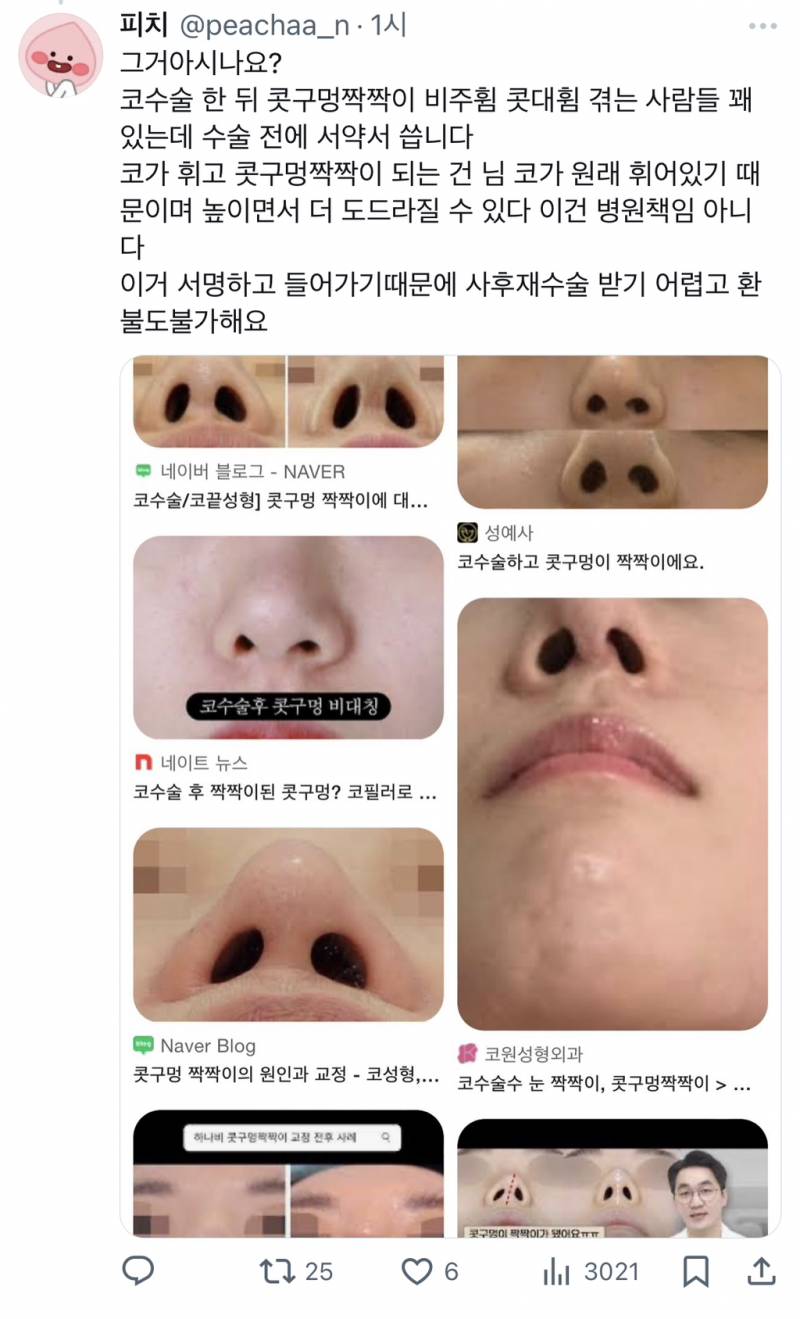 근데 코수술은 진짜 후회하는 사람 많음.twt | 인스티즈