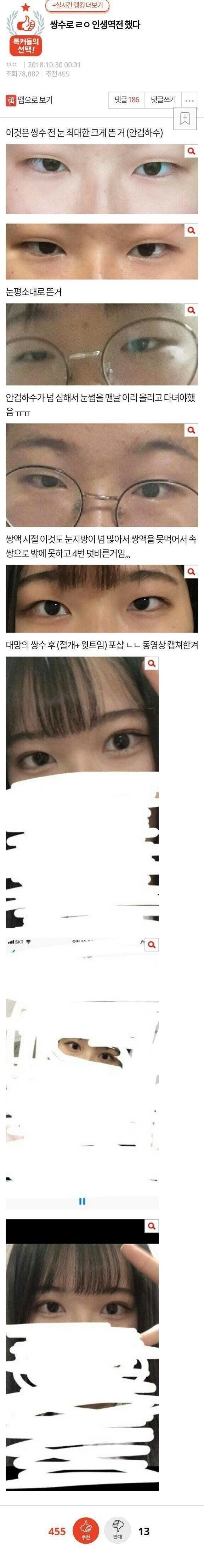 쌍수로 ㄹㅇ 인생 역전했다.jpg | 인스티즈